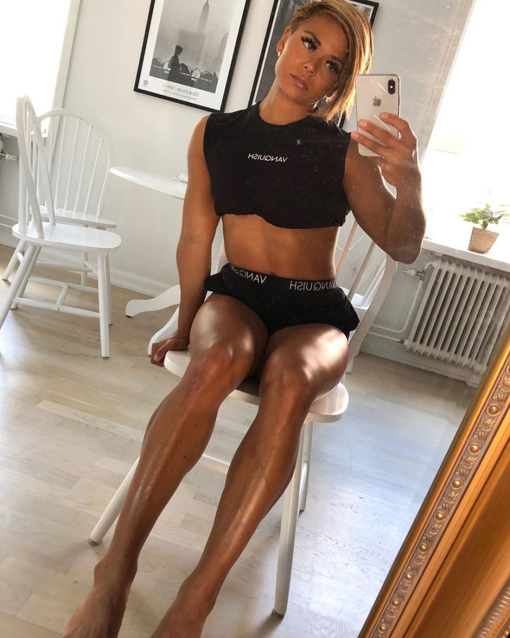 Inflated hands in women