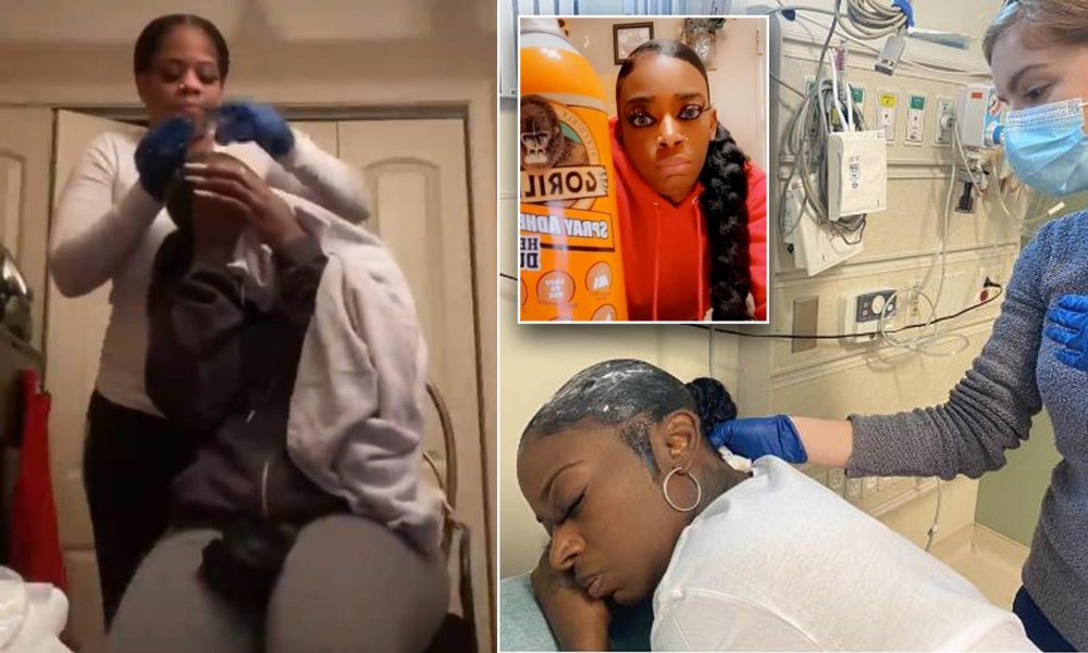 Tessica Brown, Woman Who Ussed Gorilla Glue