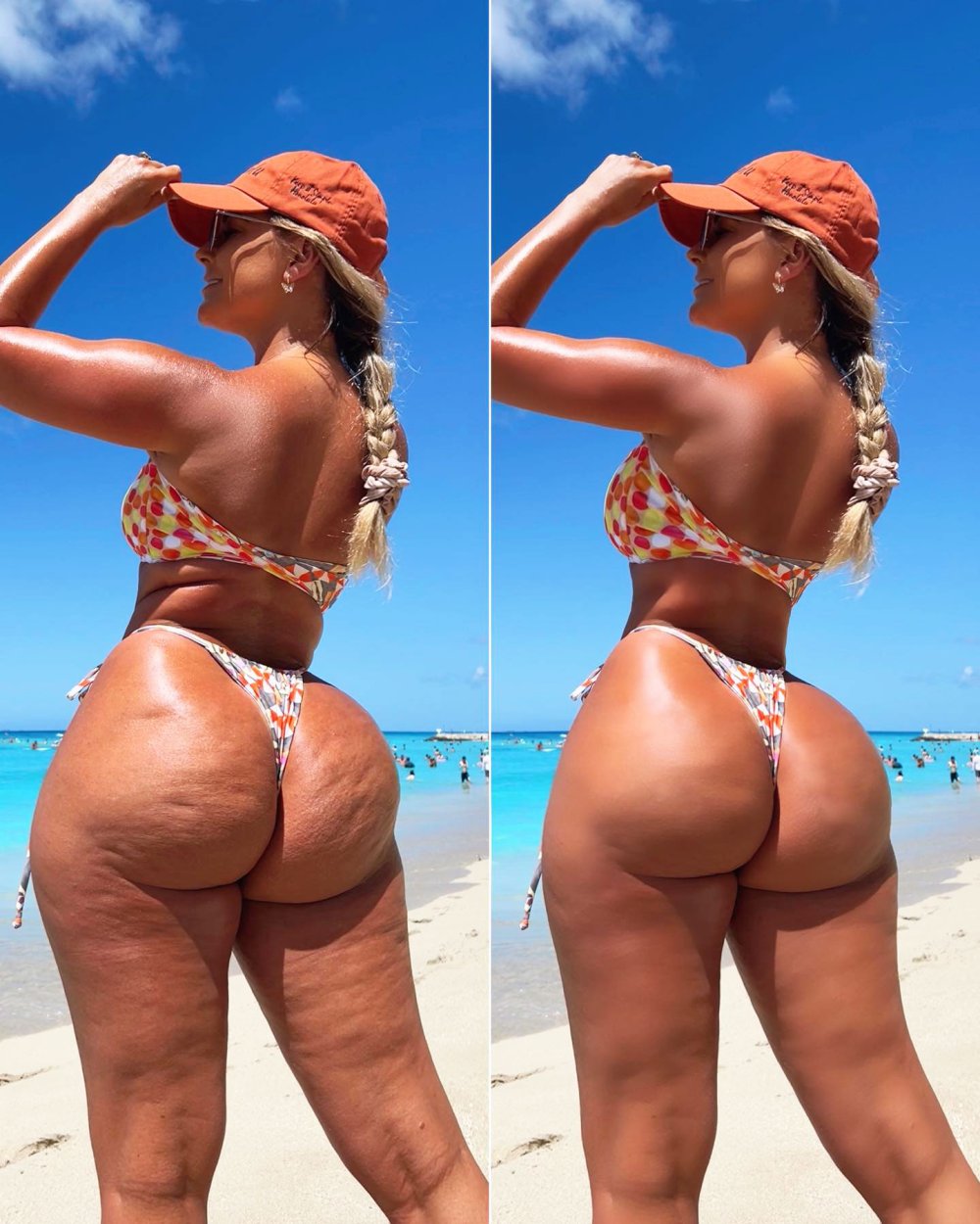 Big thighs
