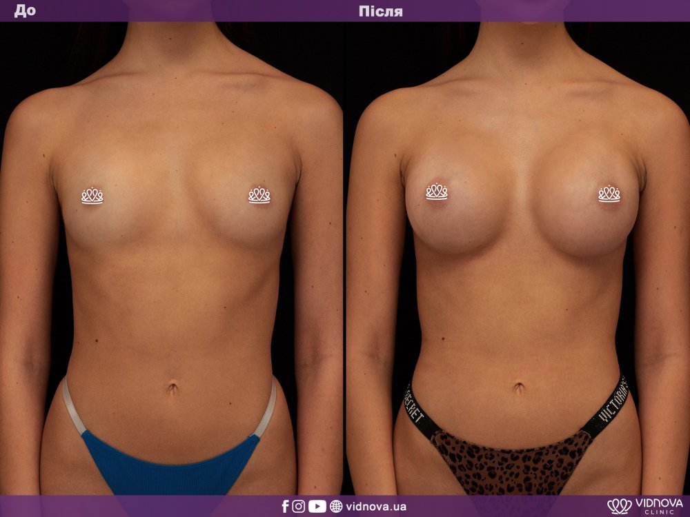 The chest is plastic