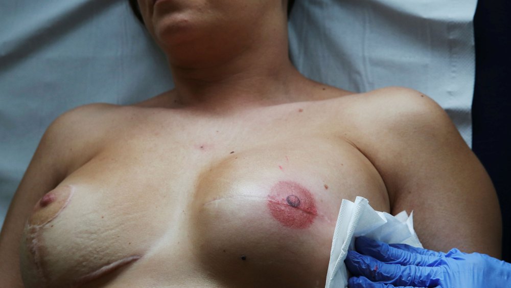 Naked female breast accident