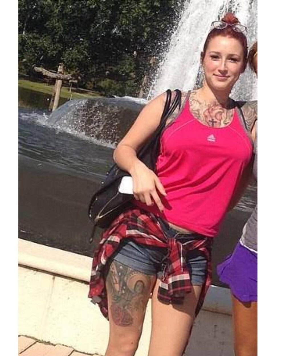 Yinyleon before surgery