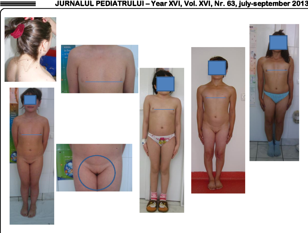 Small without clothes Puberty