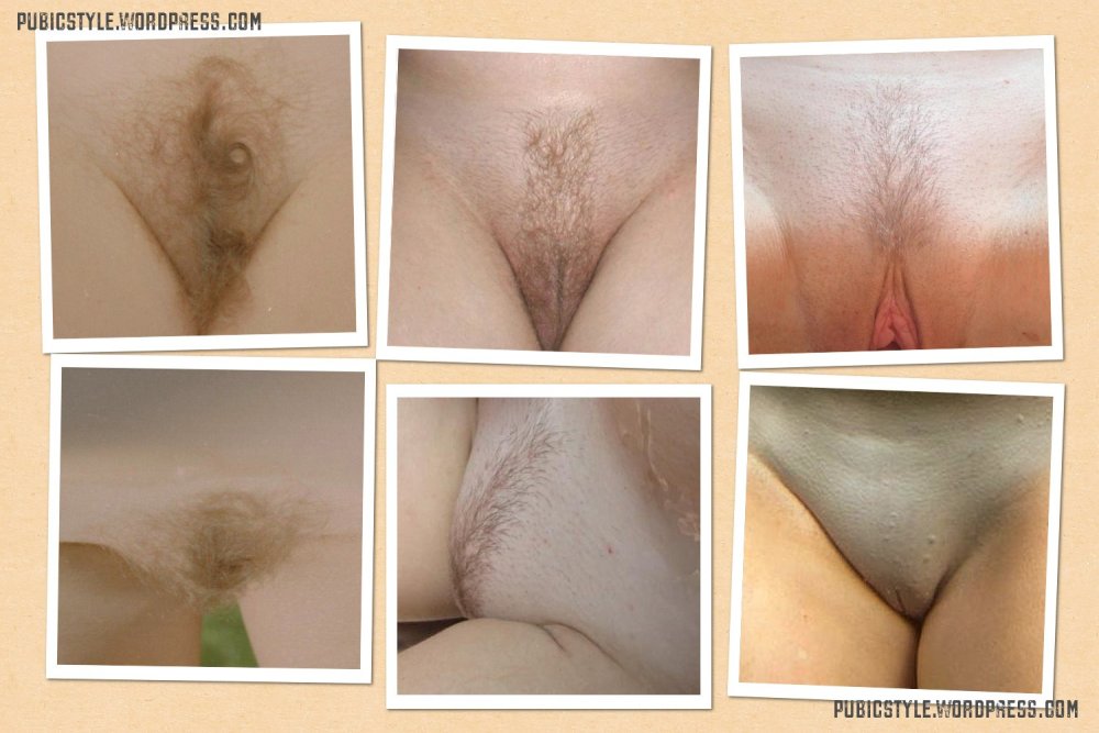 Explification of female pubis