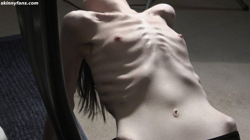 Naked anorexica