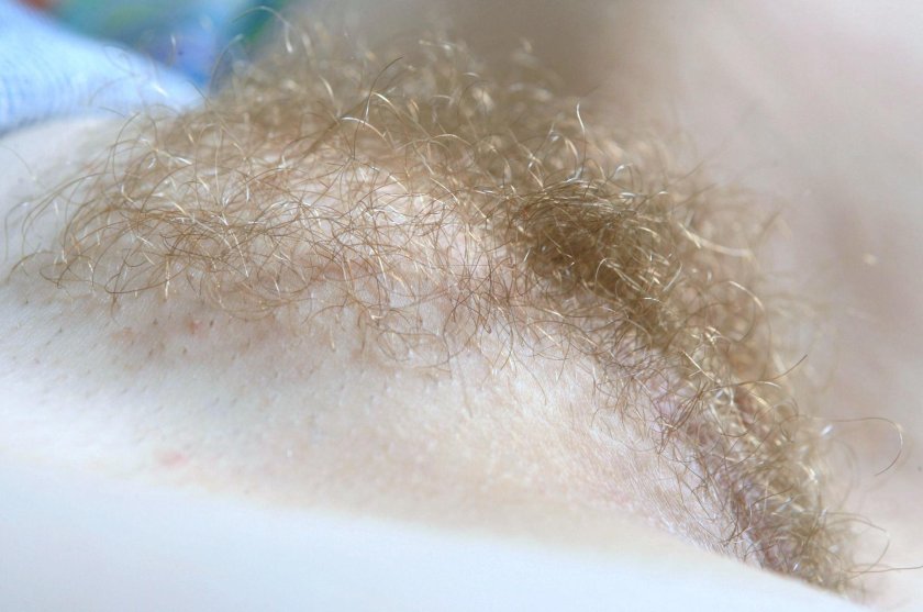 Long pubic hair