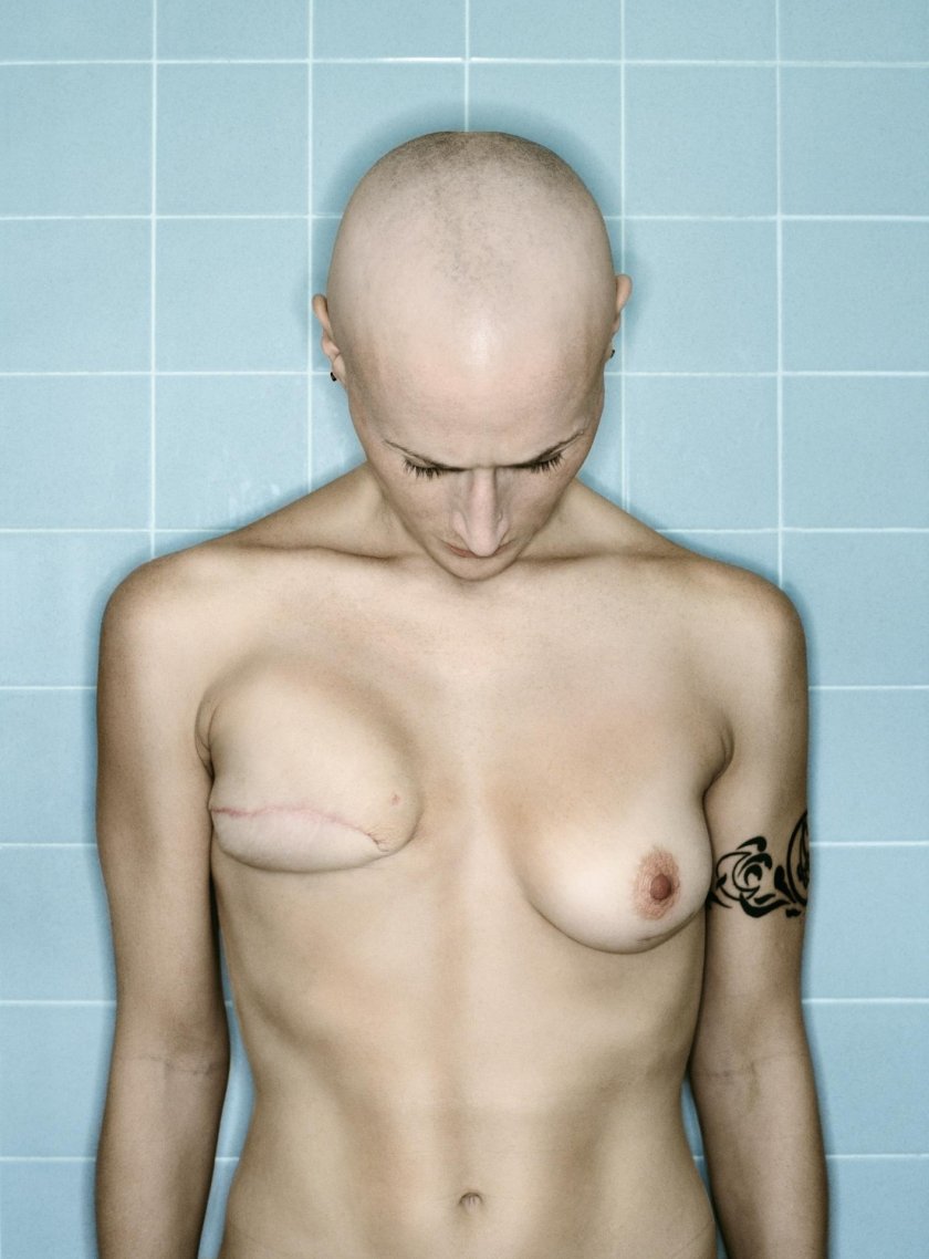 Unusual form of chest