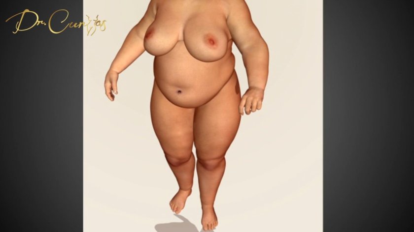 Naked woman with overweight