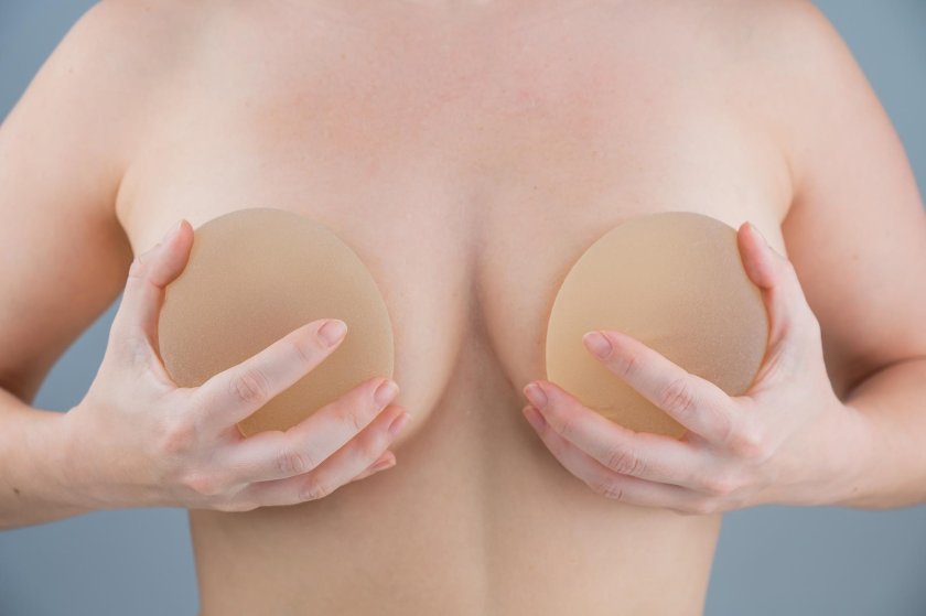 Silicone breasts