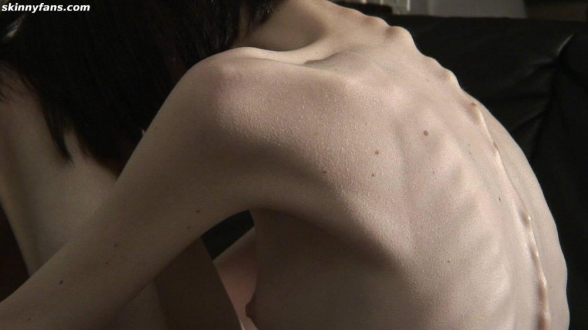 Pornstars anorexics