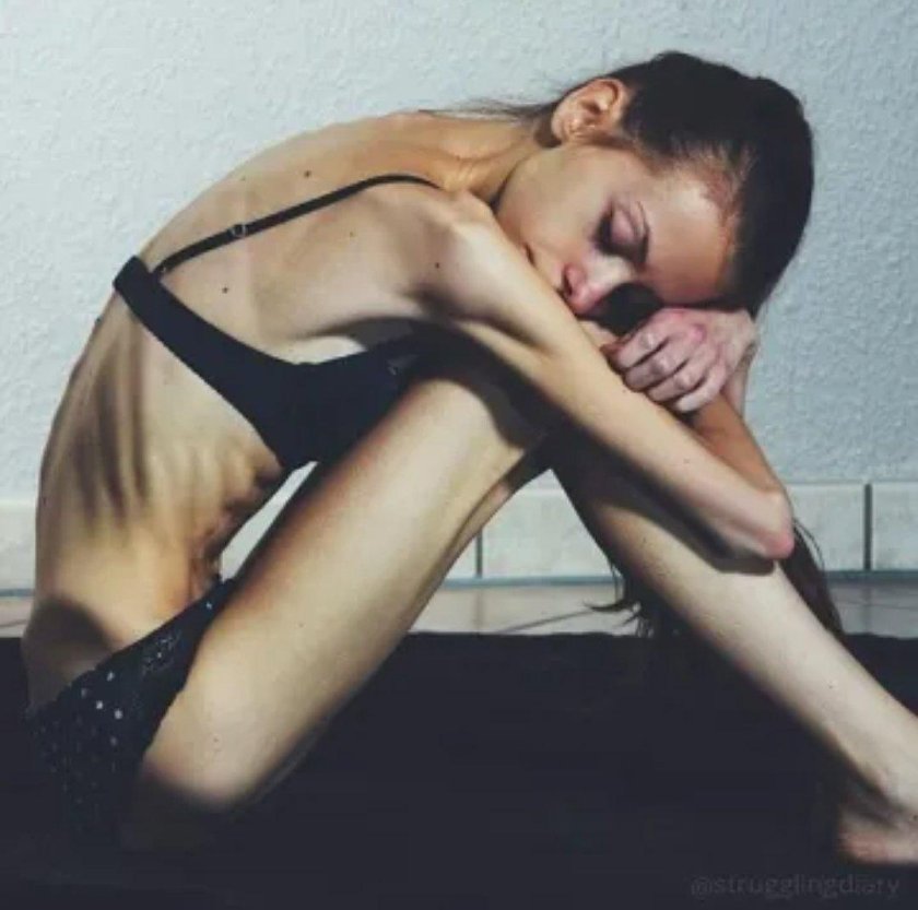 Jennifer Carpenter anorexia