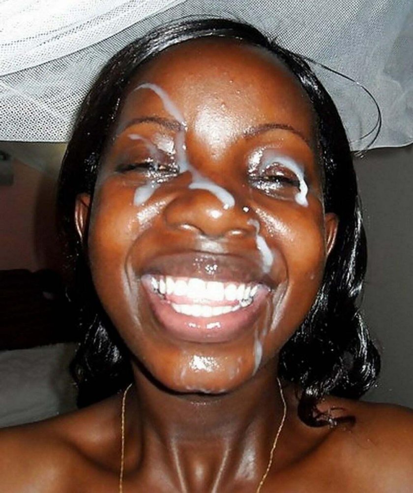 Vitiligo in African Americans