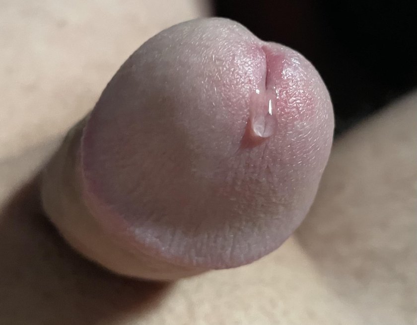 Pre ejaculate