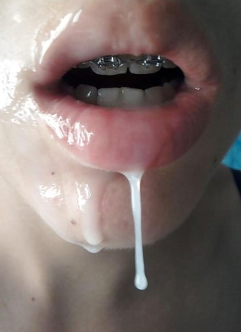 Cum girls on braces