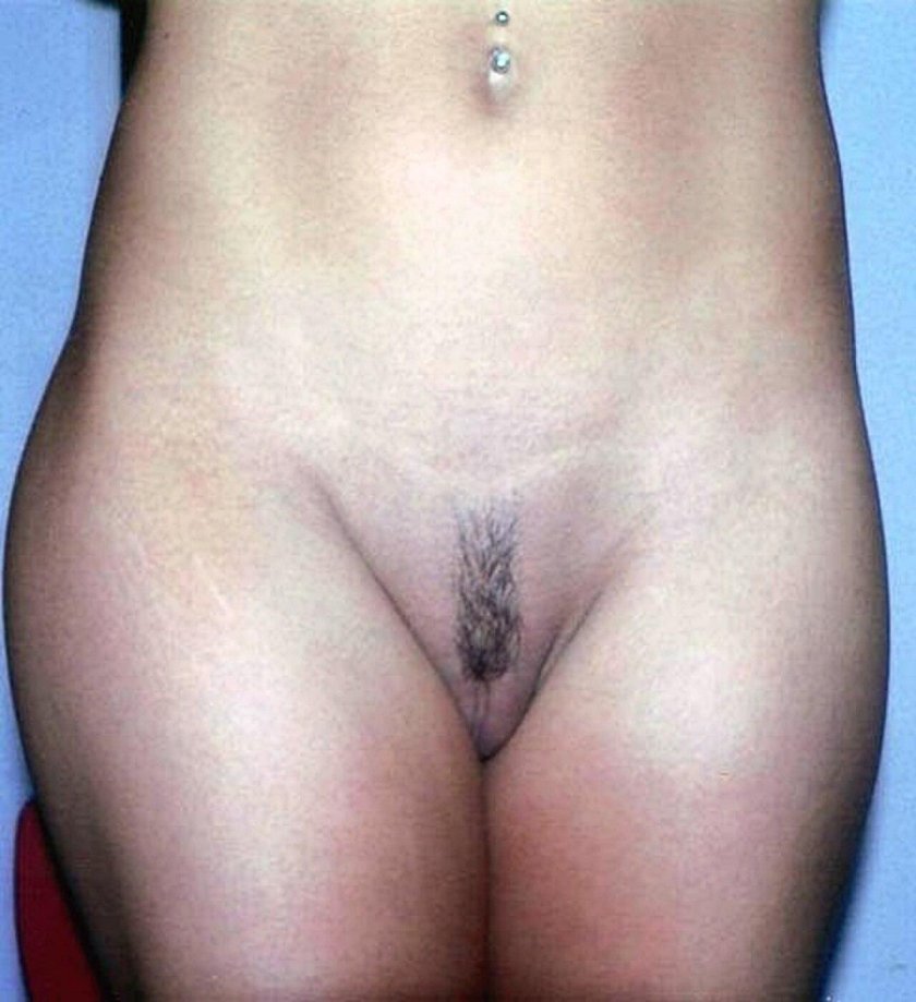 Pubic hair