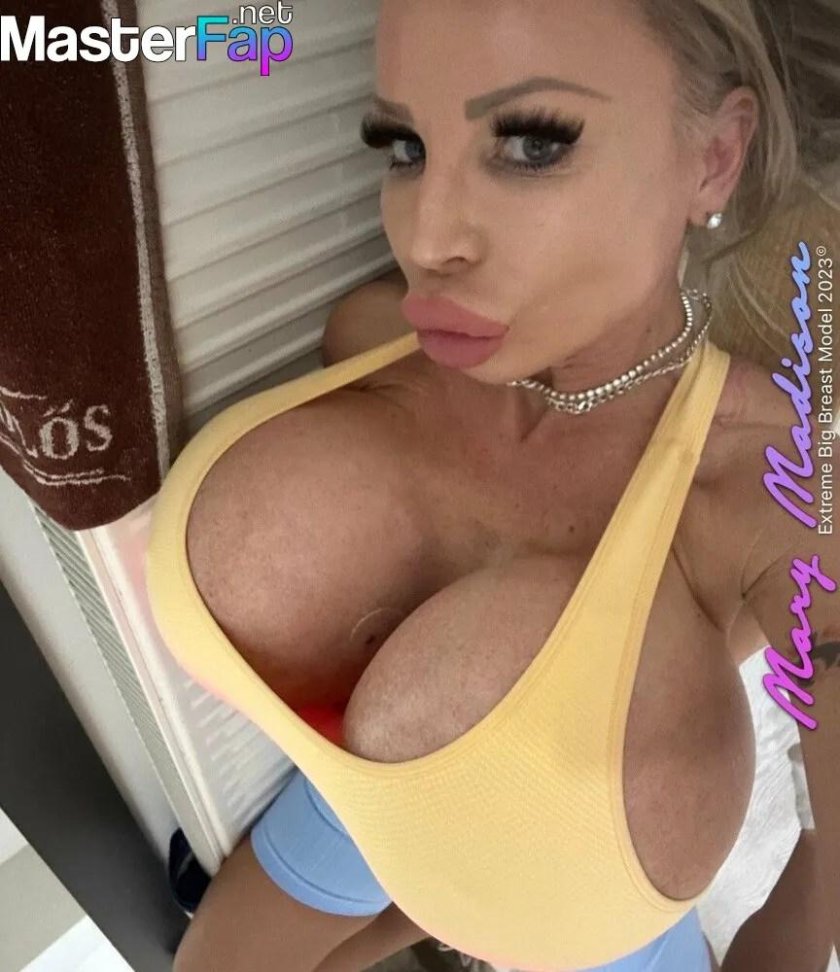 Blonde Bennett Silicone Tits
