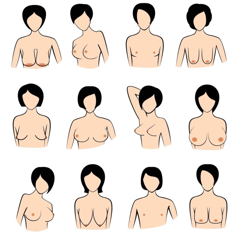 Female breast shape