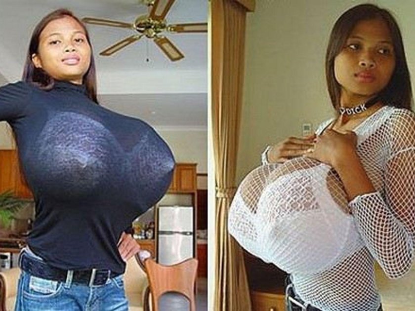 Woman with the biggest breast in world