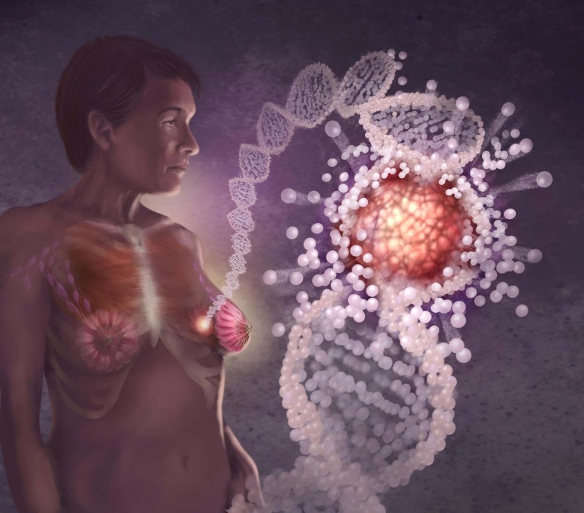 Genetic testing for breast