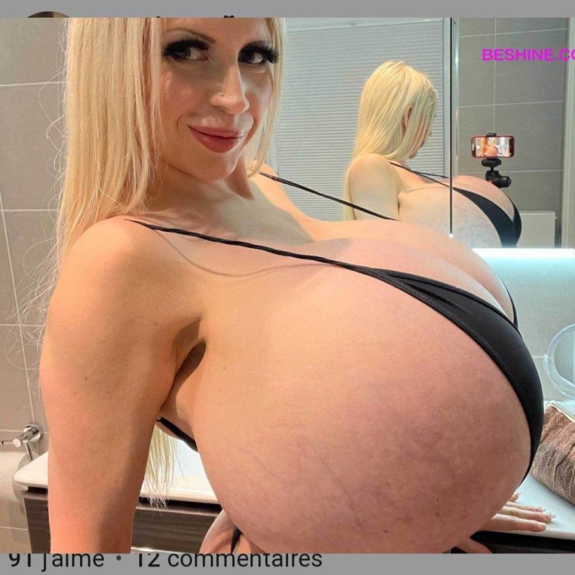 The largest silicone breasts in world