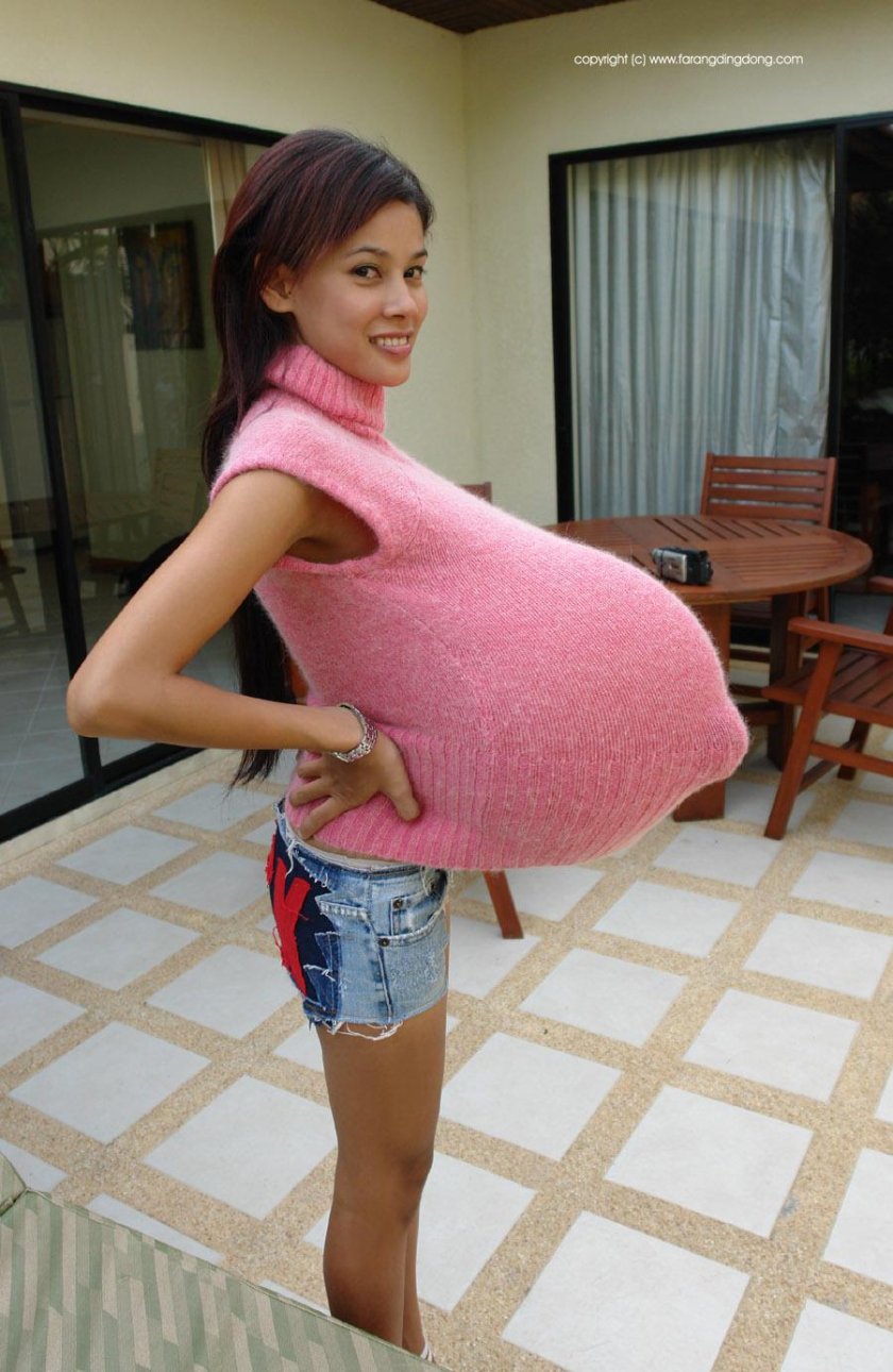 Chinese woman Ting Hiafen after surgery