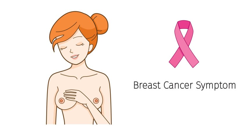 Symptoms of breast cancer