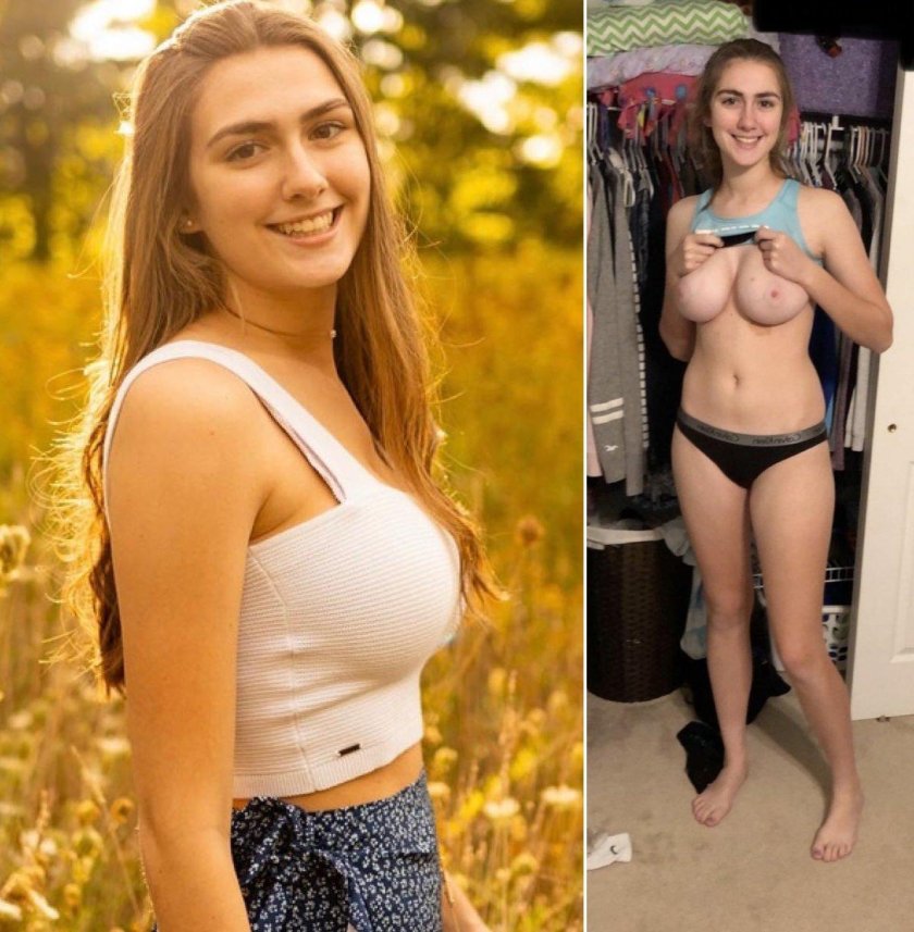 Sophie Madd Plastic surgery