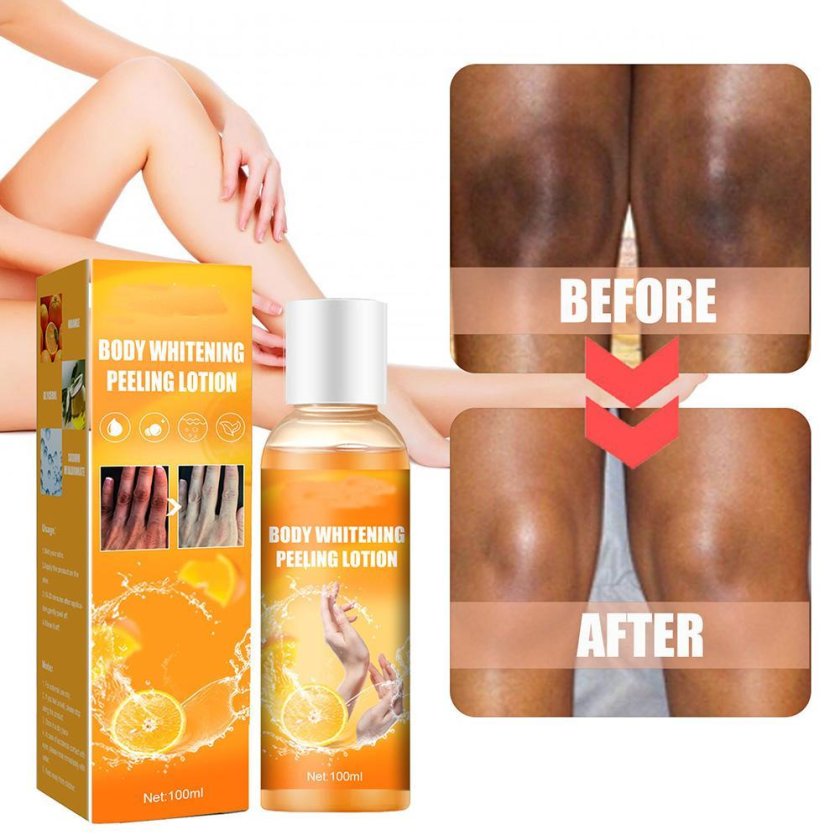 Body peeling whitening