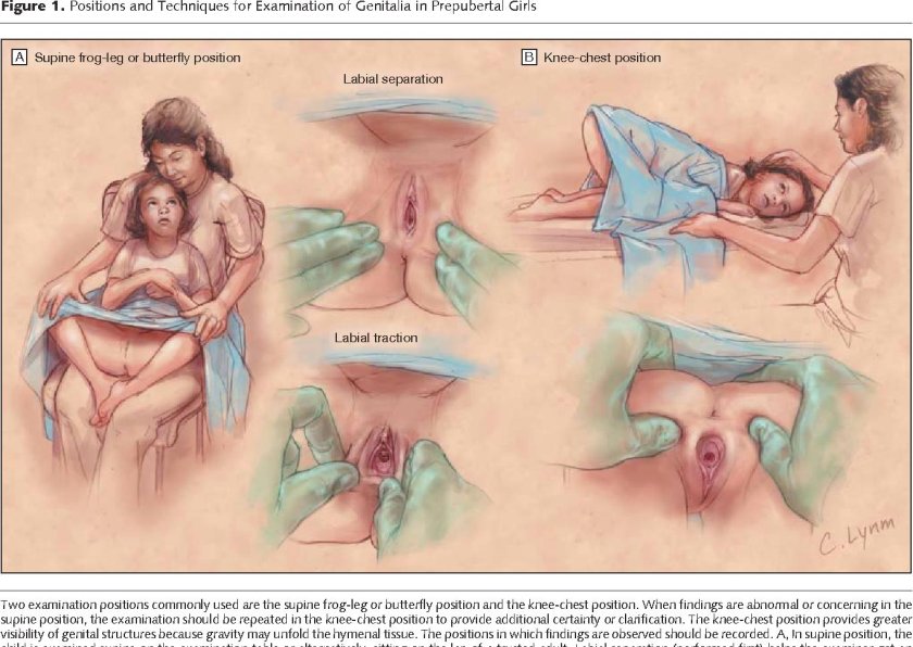 Massage of the uterus after childbirth
