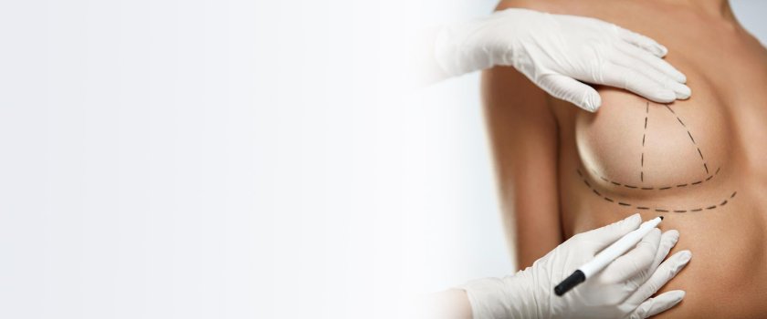 Breast prolapse surgery