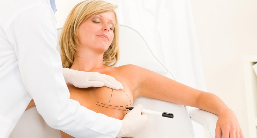 Breast plastic surgery