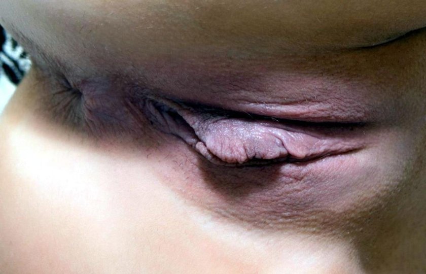 Female pussy close-up